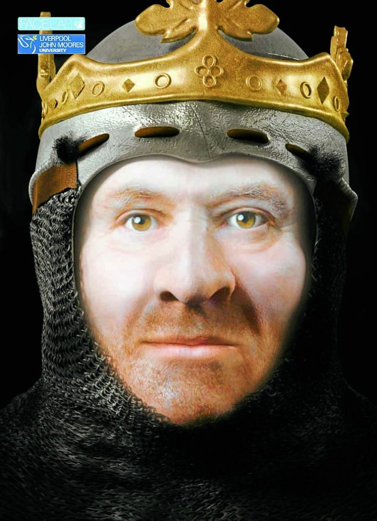 Revealed Reconstruction Of The Bruces Face Dng24